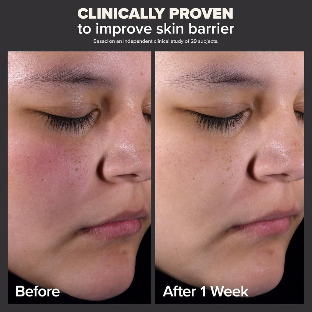  "Paula's Choice SKIN PERFECTING 2% BHA Liquid Exfoliant, 30ml bottle for blackhead and pore care."