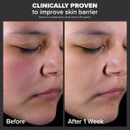  "Paula's Choice SKIN PERFECTING 2% BHA Liquid Exfoliant, 30ml bottle for blackhead and pore care."