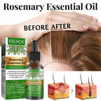 "Rosemary Hair Growth Essential Oil – Natural oil for promoting healthy hair growth, reducing hair loss, and nourishing scalp and strands."