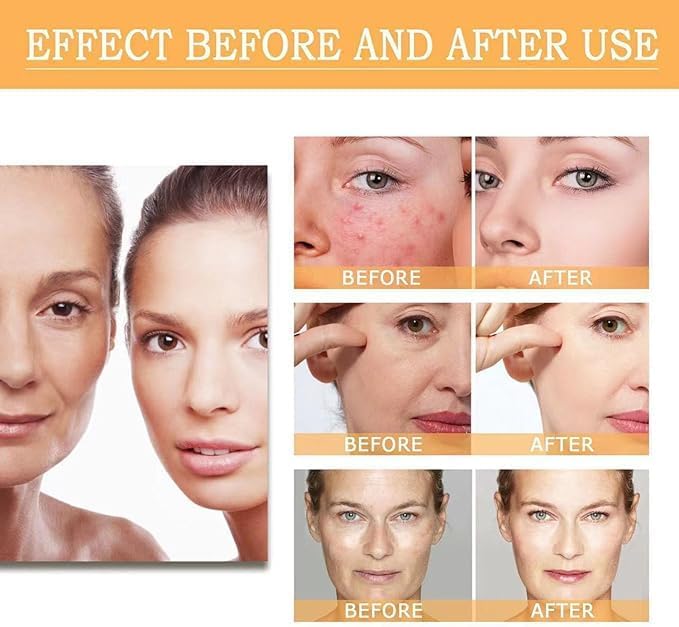 The Ordinary Glycolic Acid 7% Exfoliating Toner, 100ml bottle. Exfoliating toner for smoother, brighter skin by The Ordinary.